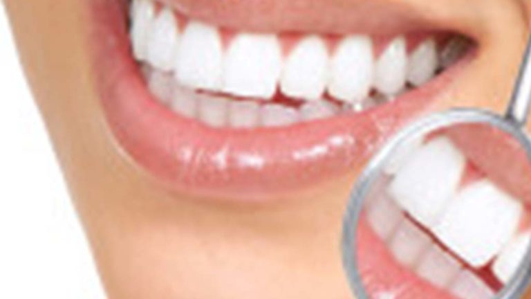 Shinny white teeth on a dental check up